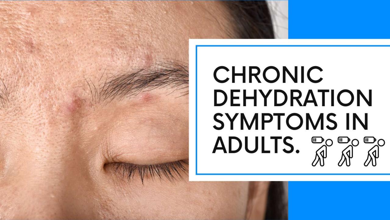 What Are The Common Signs Of Chronic Dehydration In Adults